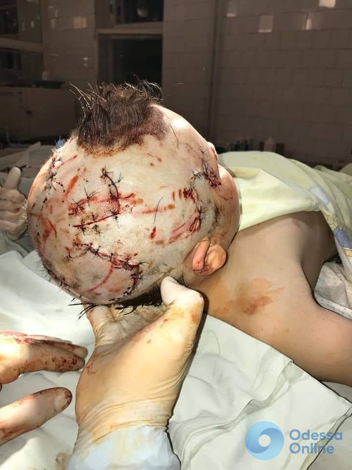 Собака напала на маленькую девочку в Одессе: ребенок в реанимации (осторожно, фото)