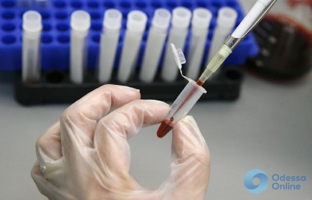 В Одесской области четверо школьников подхватили вирусный гепатит