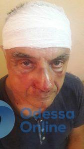 В Измаильском районе избили депутата облсовета