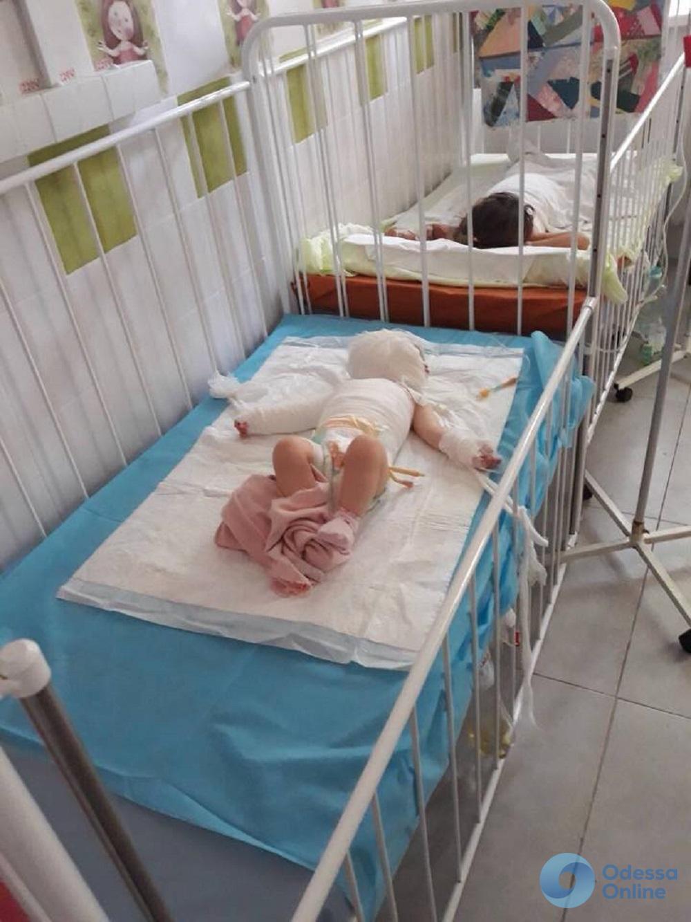 Ожоги кипятком и химическим средством: в одесской больнице спасают жизни двух маленьких девочек