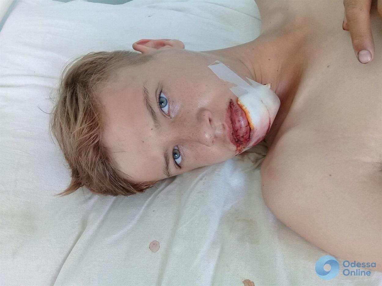 В сети появилось видео смерча в Беляевке, во время которого серьезно пострадал подросток