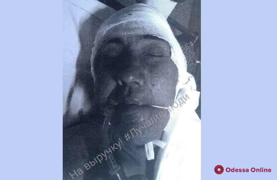Одесса: впавший в кому мужчина скончался в больнице