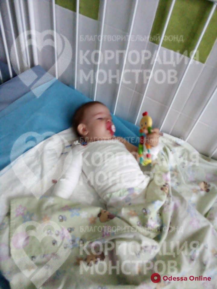 В Одесской области 11-месячная девочка обварилась кипятком из чайника