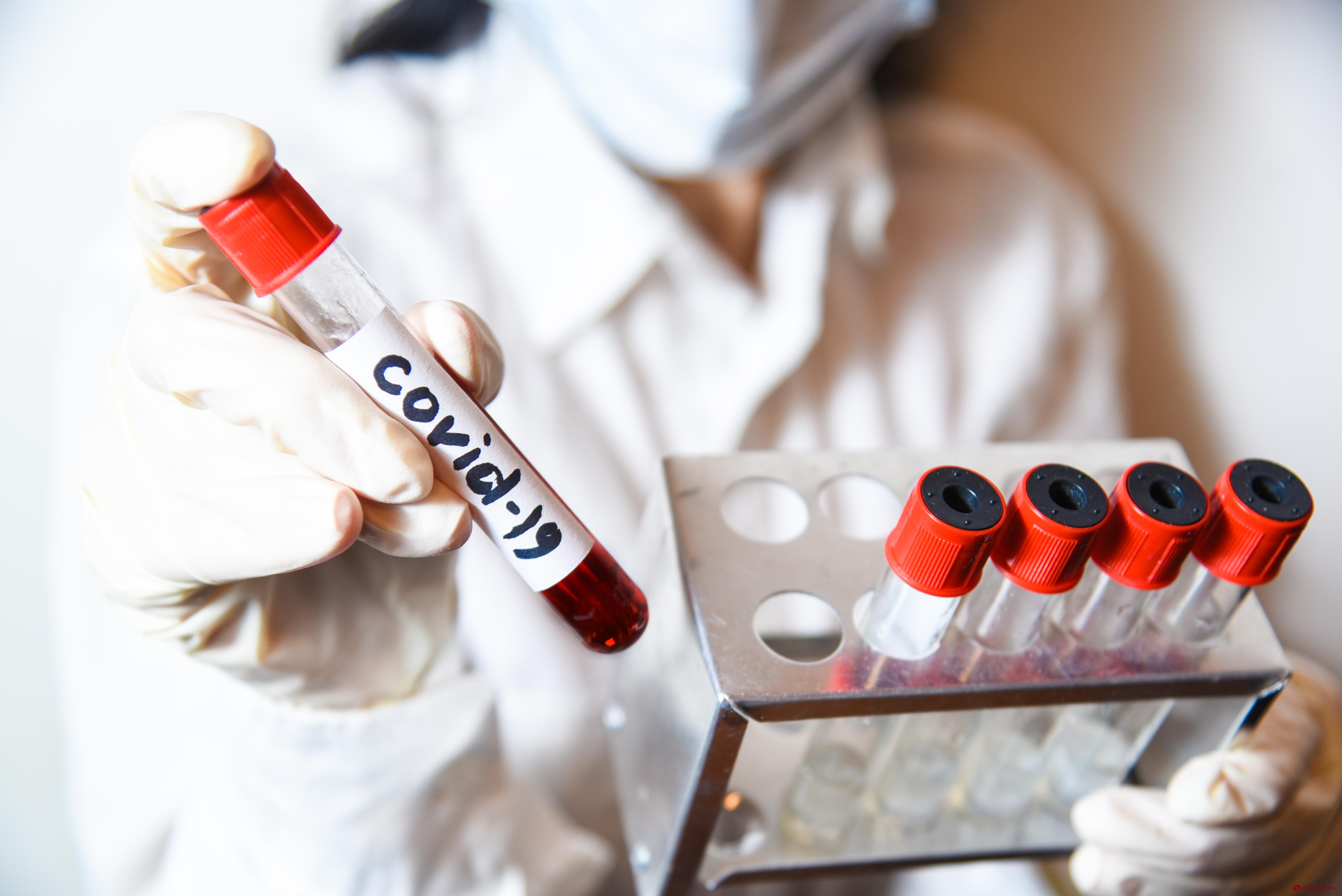 На прошлой неделе в Украине зафиксировано почти 23 тысячи случаев заражения коронавирусом