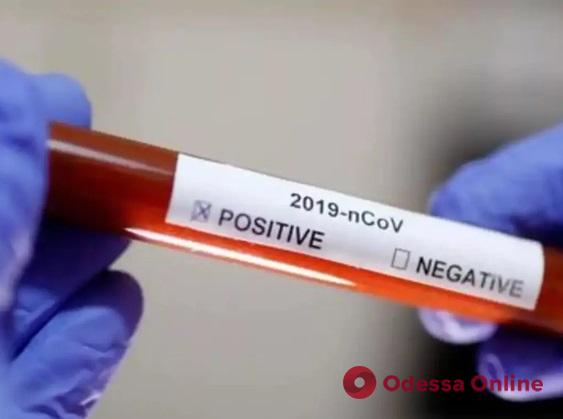 Одесская инфекционная больница закупает экспресс-тесты на коронавирус