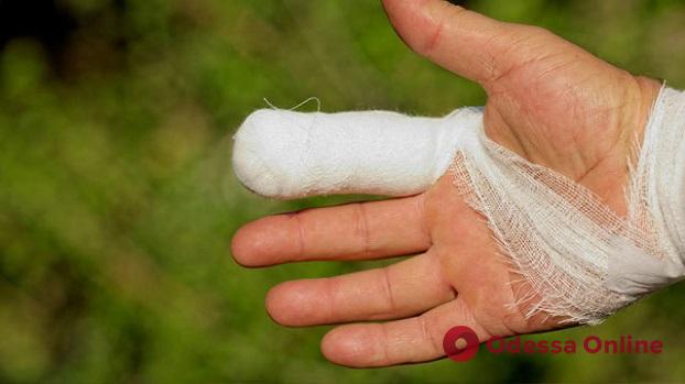 На Таирова во время конфликта на улице неадекват откусил палец одесситке