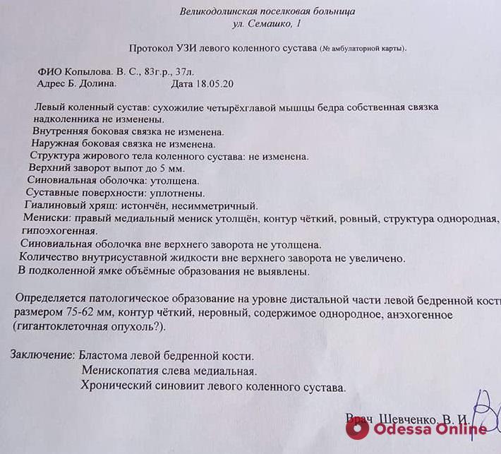 Опухоль кости: жительница Великодолинского нуждается в срочной помощи
