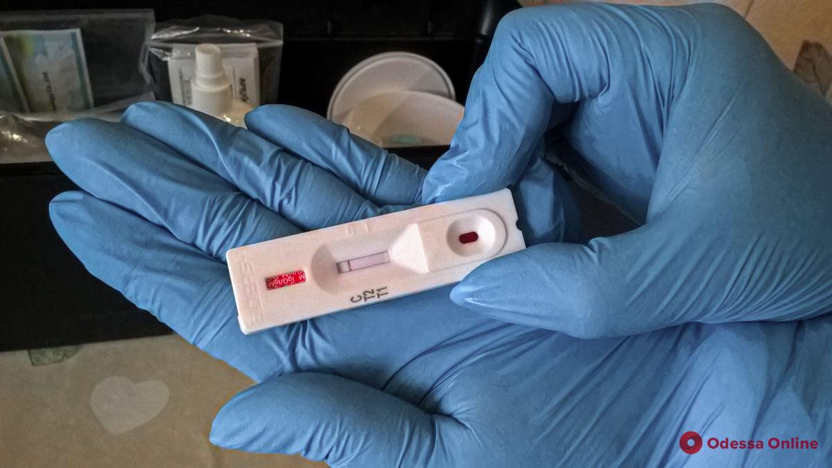 Одесса закупила ИФА-тесты на антитела к коронавирусу
