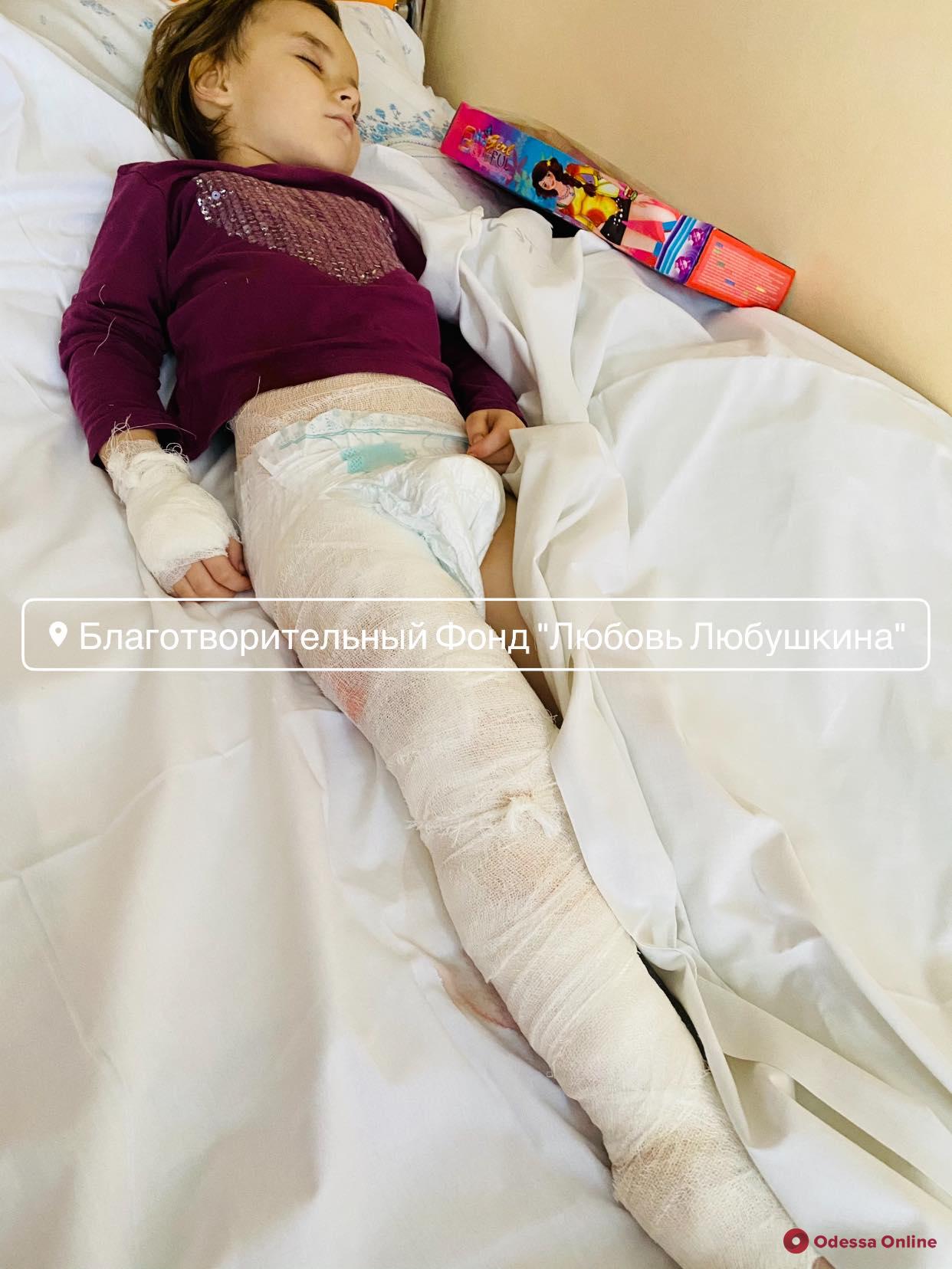 Обварилась кипятком: в одесской больнице прооперировали 4-летнюю девочку