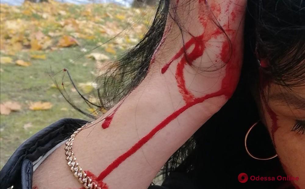 Сцена ревности закончилась побоями: в Одесской области женщине разбили голову
