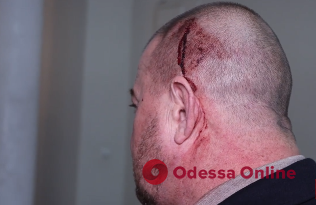Нардеп Дмитрук во время потасовки в мэрии разбил голову директору одесских муниципалов