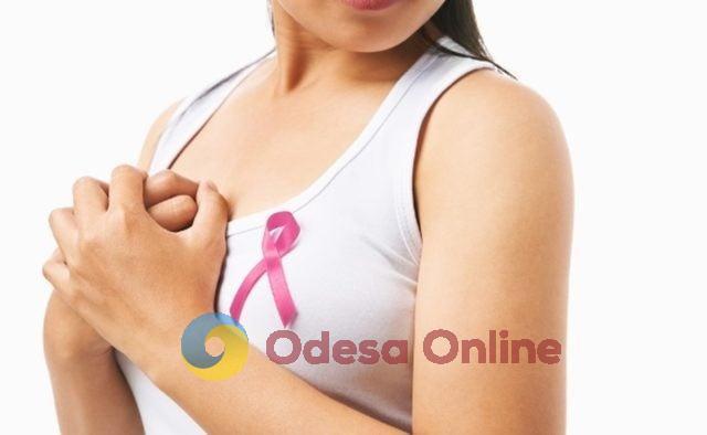 На Одещині до кінця року працюватимуть пересувні мамологічні кабінети – перевірка безкоштовна