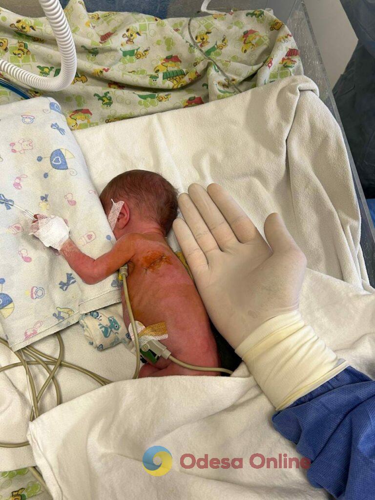 Одеські кардіохірурги врятували немовля із вродженою вадою серця
