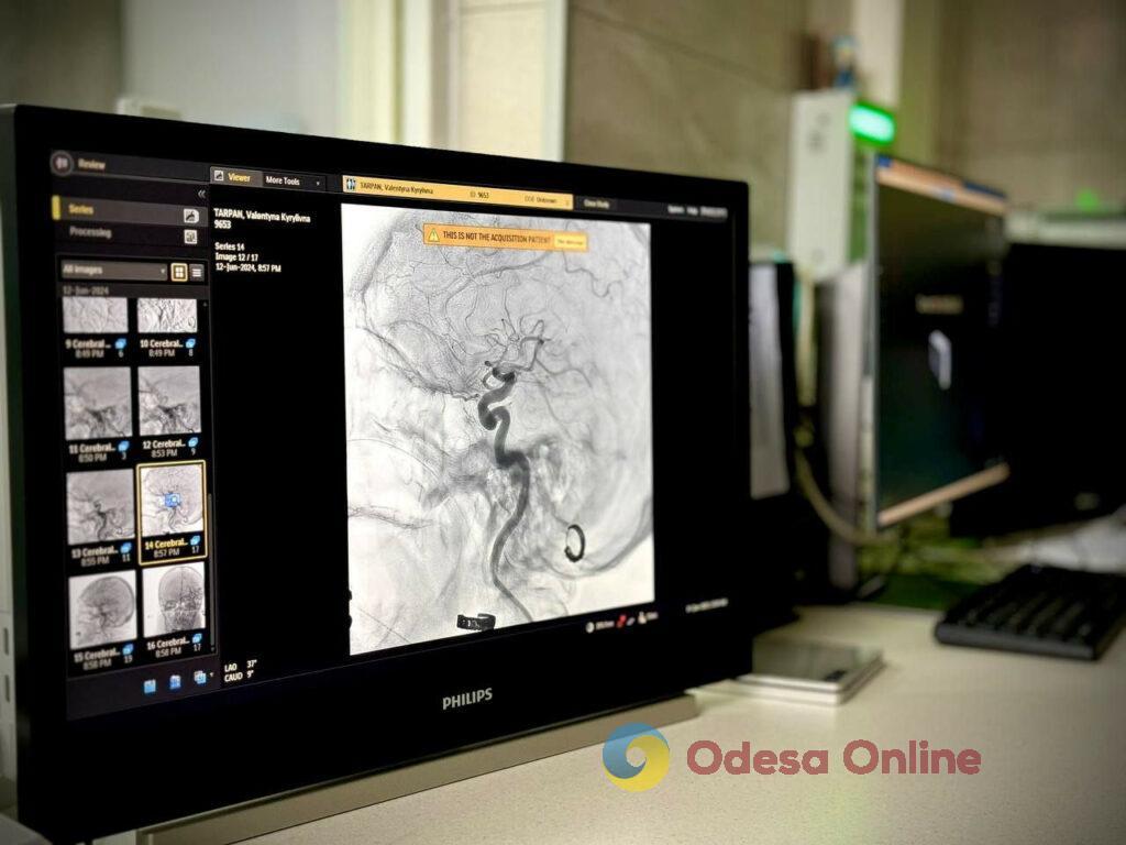 В одній із одеських лікарень встановили сучасний ангіограф