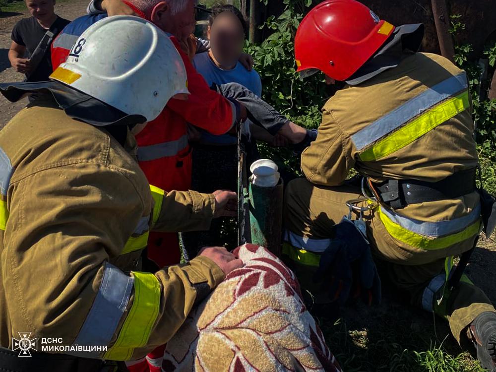 Наткнулся на металлический пик: в Николаевской области травмировался ребенок