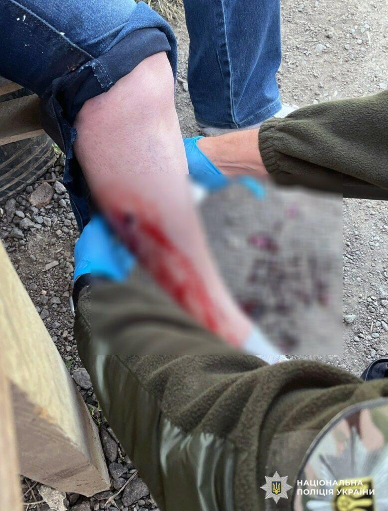 За добу на Херсонщині внаслідок російських обстрілів одна людина загинула та 14 поранено