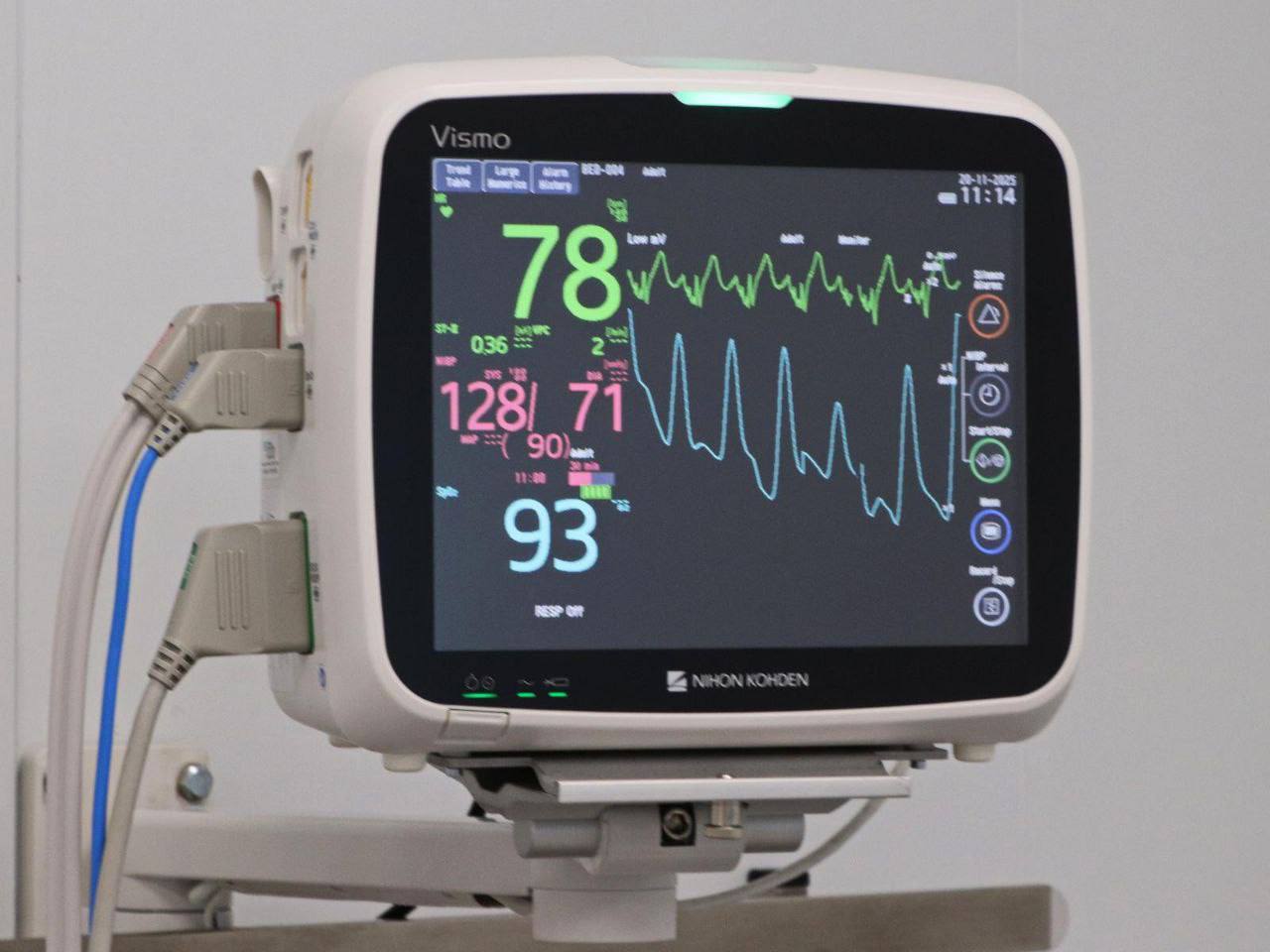 Близько 1000 пацієнтів уже пройшли лікування в новому відділенні кардіології в Одесі