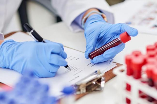 ГРВІ нижче епідпорогу, менше кишкових інфекцій і два випадки підозри на Лайма: епідситуація на Одещині ГРВІ нижче епідпорогу, менше кишкових інфекцій і два випадки підозри на Лайма: епідситуація на Одещині