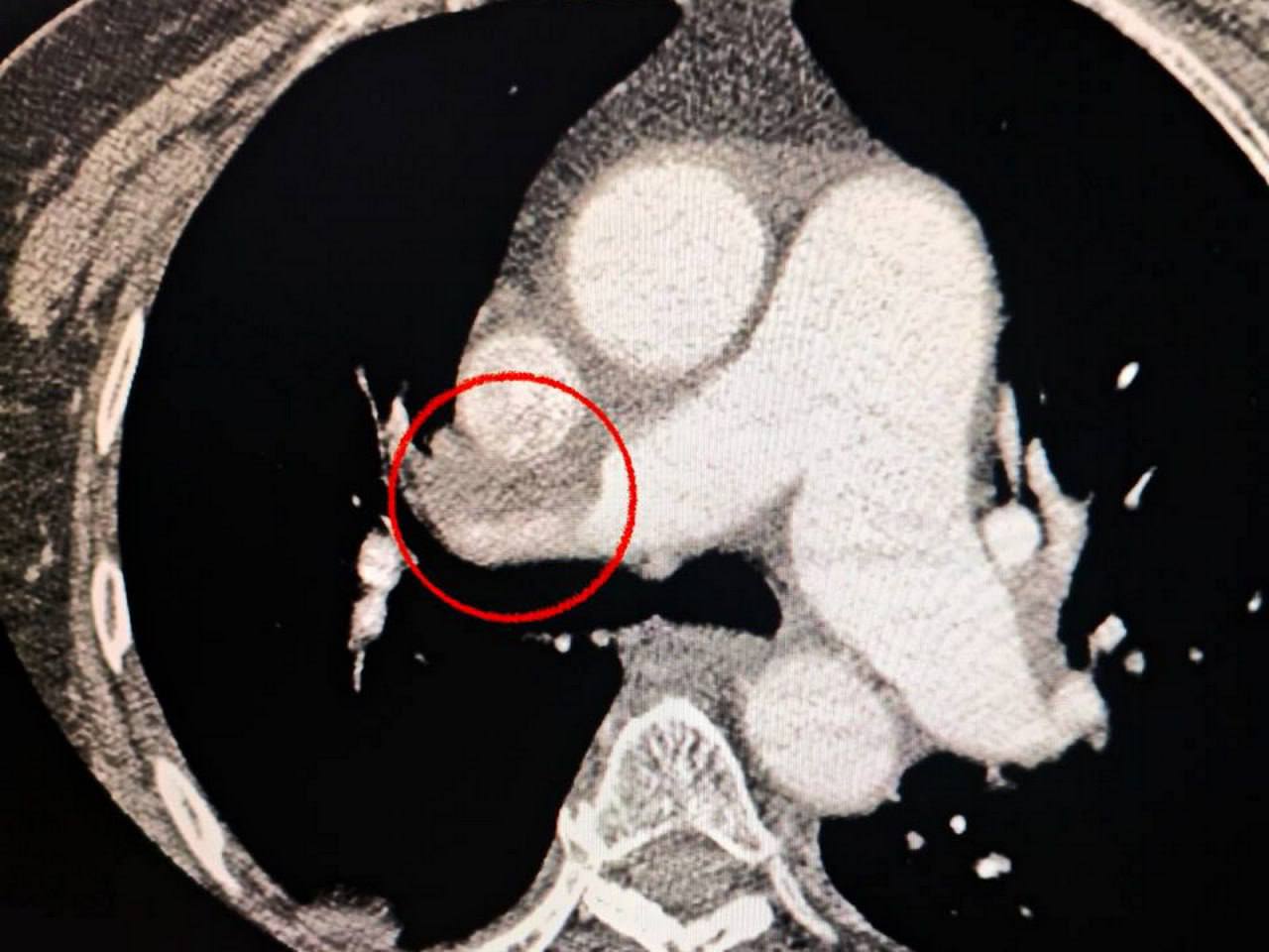 Врятоване життя: одеські медики провели унікальну подвійну операцію