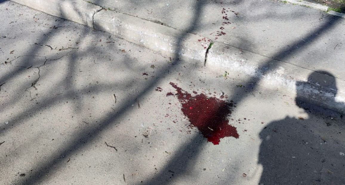 В Херсонской области из-за обстрелов погибли пятеро людей, четверо ранены