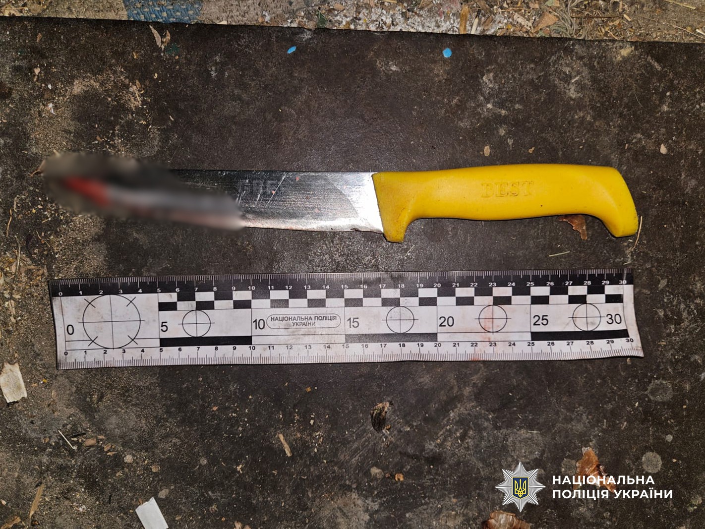 На Одещині 71-річна жінка вдарила подругу ножем &mdash; постраждала померла під час операції