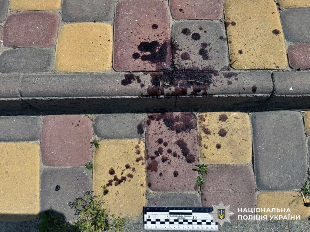 На Херсонщині внаслідок російських обстрілів поранені семеро людей В Херсонской области в результате российских обстрелов ранены семь человек