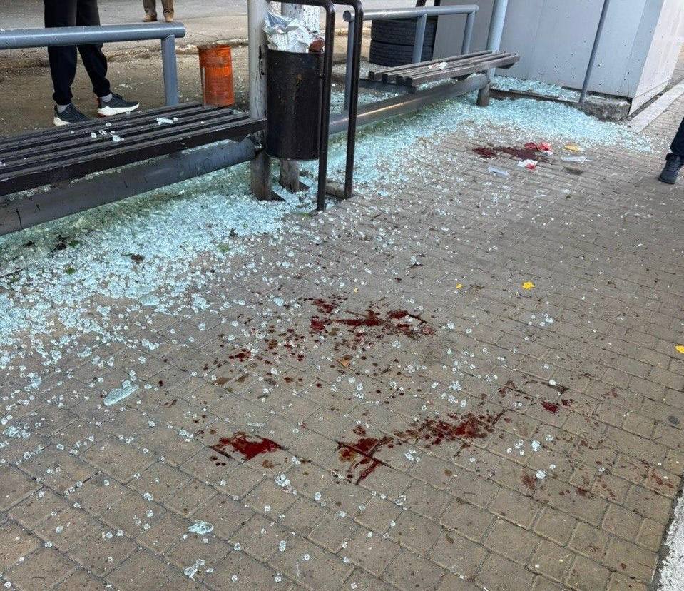 В результате утренней атаки РФ на остановке общественного транспорта в Одессе пострадали три человека (обновлено) В результате утренней атаки РФ на остановке общественного транспорта в Одессе пострадали три человека (обновлено)
