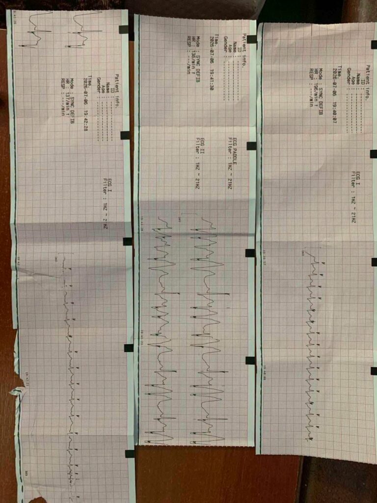 Медики экстренной помощи спасли женщину на вокзале в Одессе